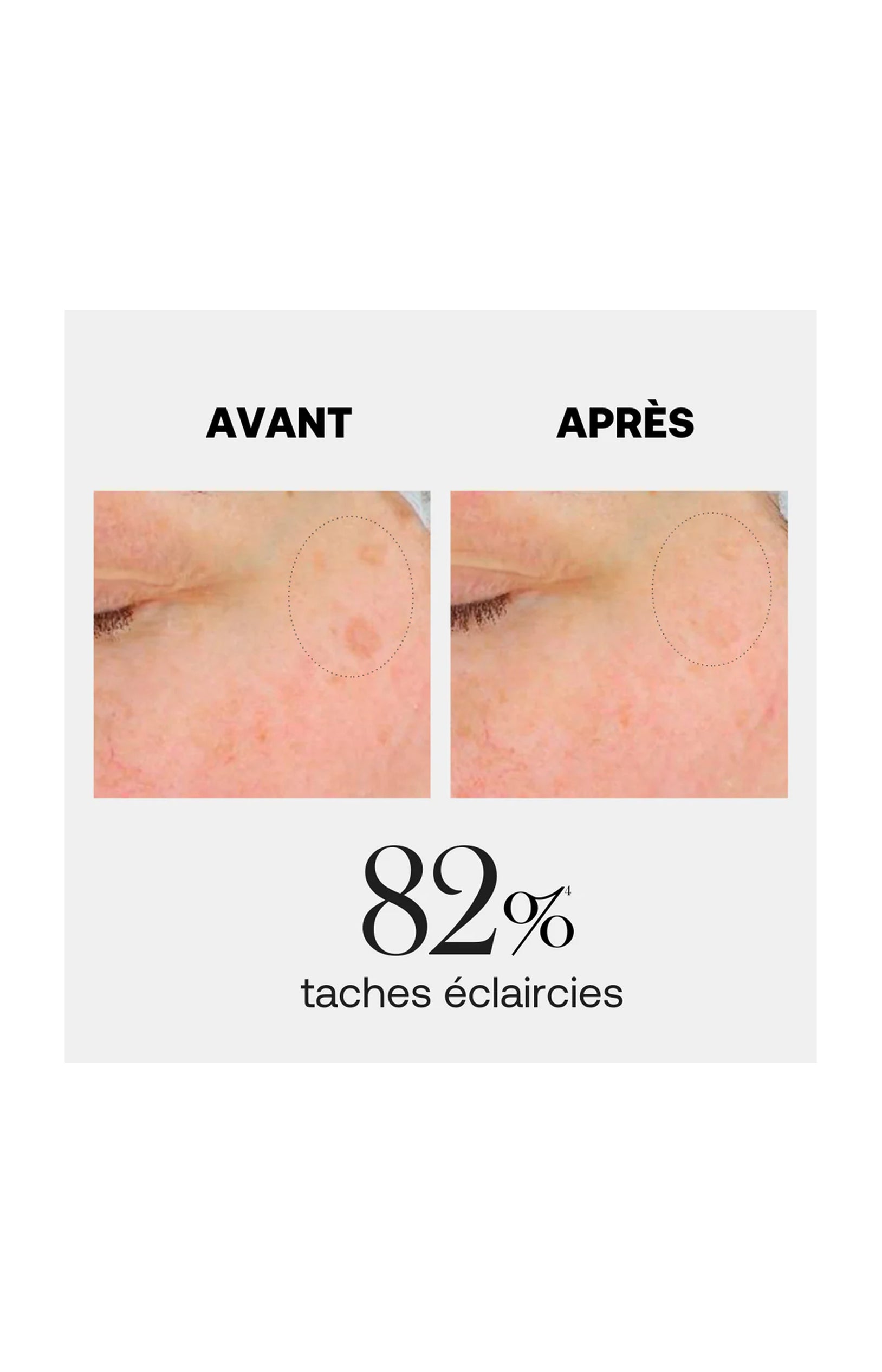 Sérum anti-tâches uniformisant - Acide hyaluronique & niacinamide - Crystal Bright - Visage - 30 ml