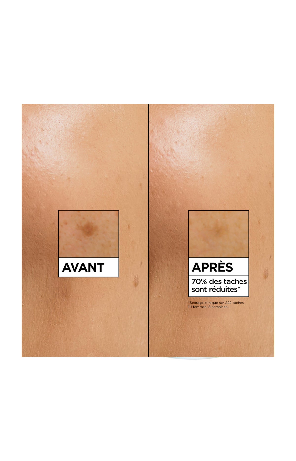 Sérum éclat anti-tâches - Vitamine C - Visage