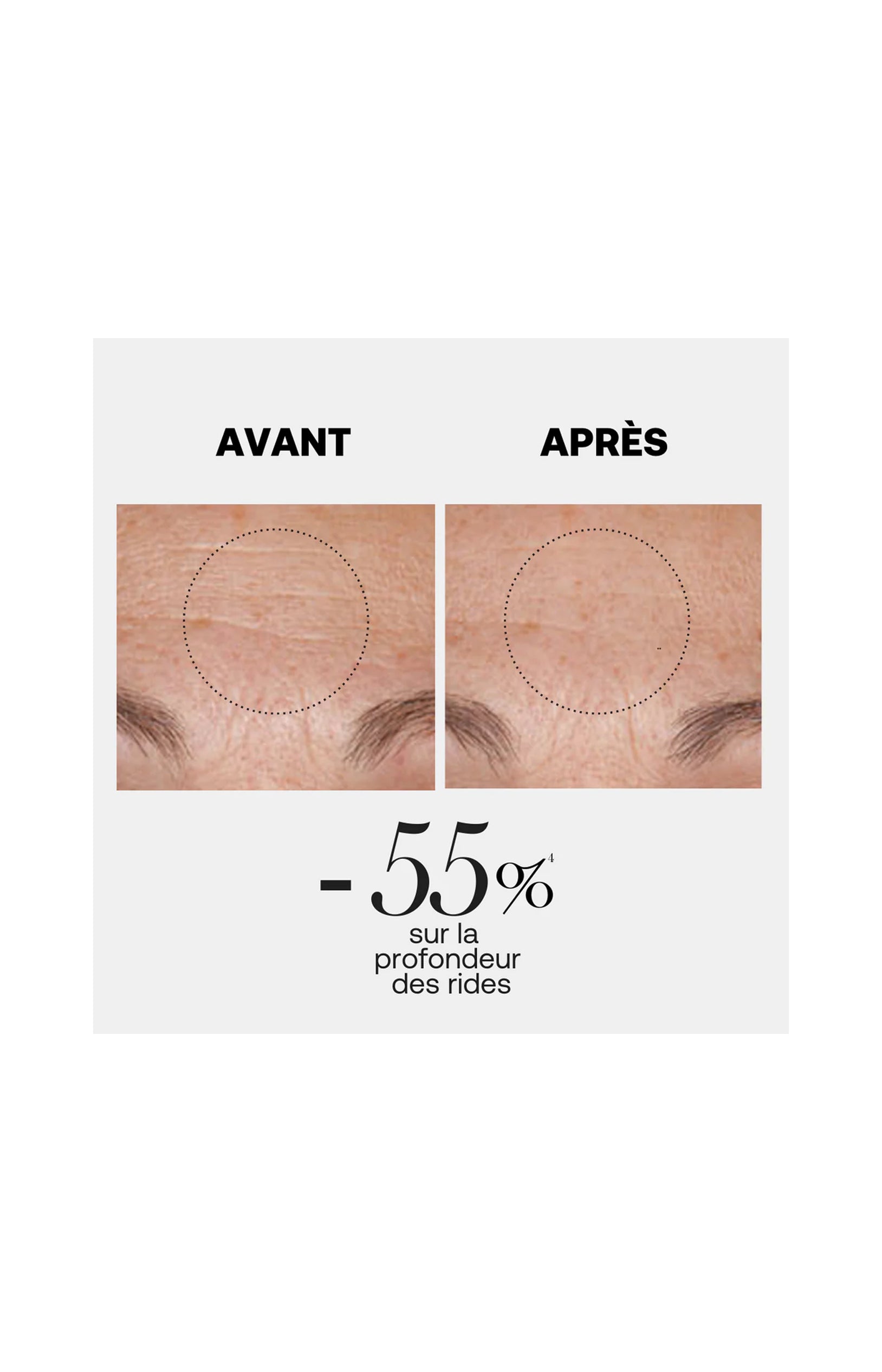 Crème riche régénérante anti-âge - Line killer - Visage