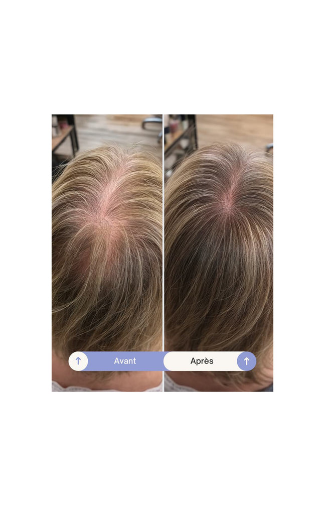 Sérum fortifiant - Grow Perfect - 100 ml