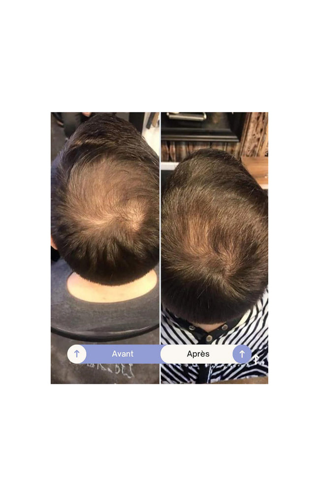 Sérum fortifiant - Grow Perfect - 100 ml