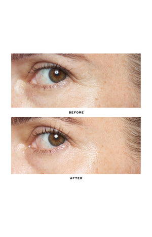 Sérum anti-âge - Retinol - Transform - 30 ml