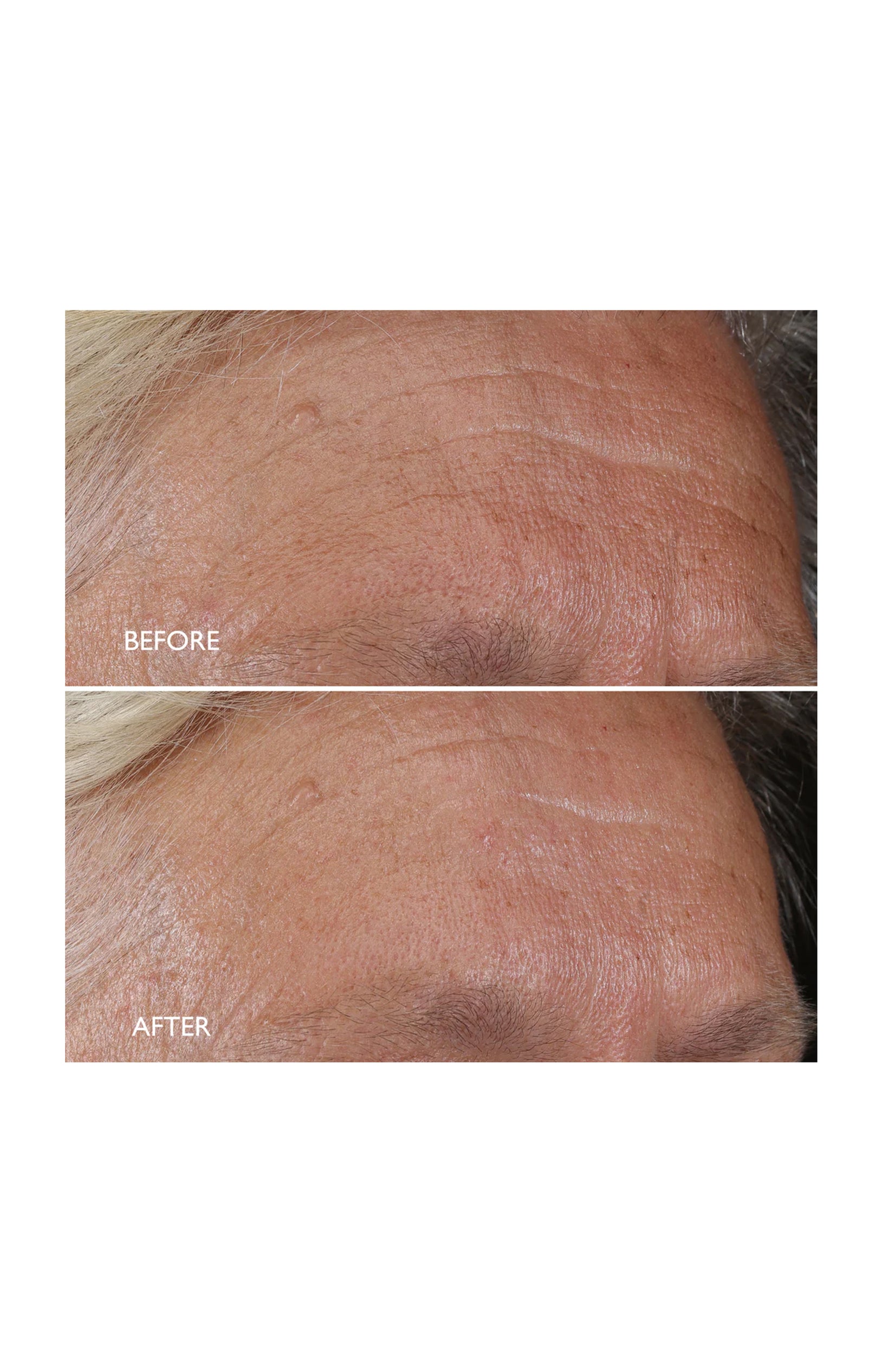 Crème de nuit régénérante  - Age Benefit - Lotus - Visage - 50 ml