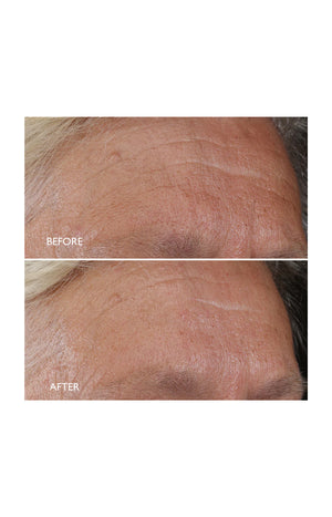 Crème de nuit régénérante  - Age Benefit - Lotus - Visage - 50 ml