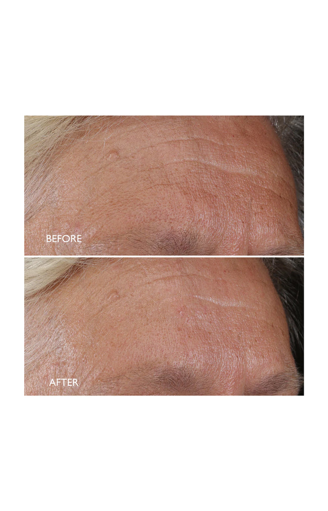 Crème de nuit régénérante  - Age Benefit - Lotus - Visage - 50 ml