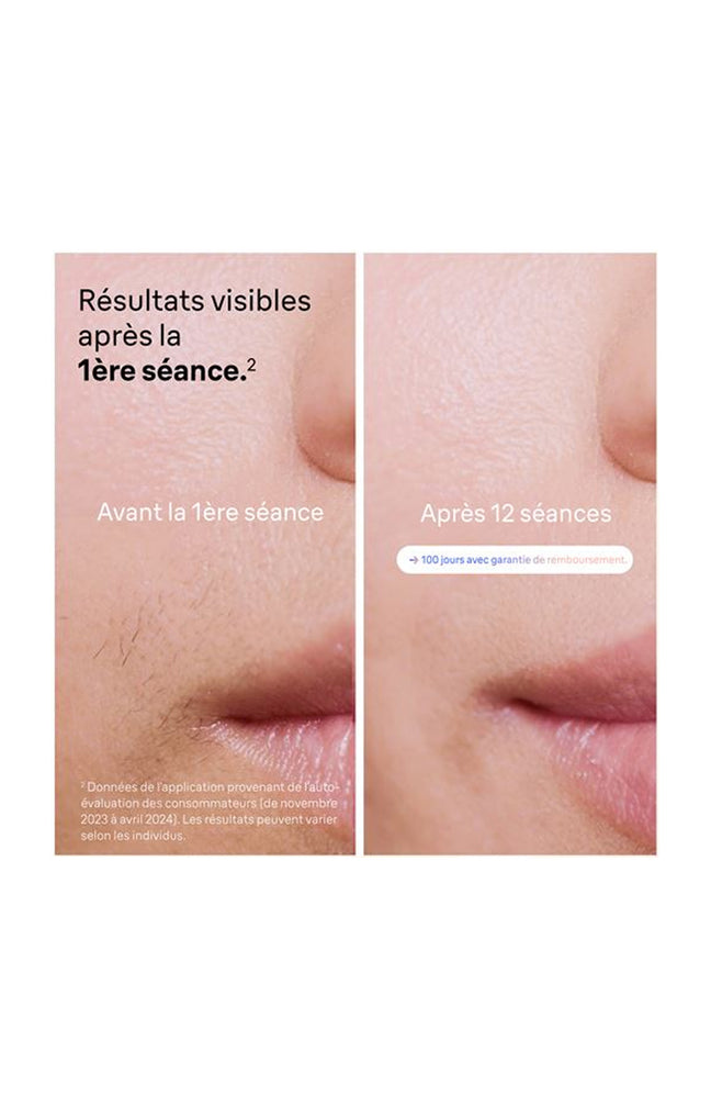 Épilateur lumière pulsée - Smart IPL 7 Skin i·expert PL7147 - Corps & visage