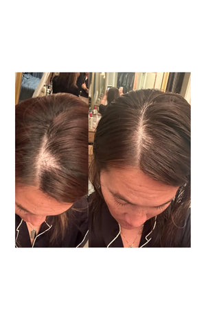 Sérum de croissance cheveux - G'Hair - 60 ml