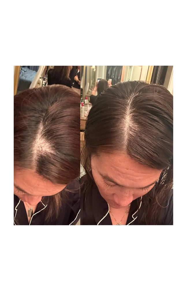 Sérum de croissance cheveux - G'Hair - 60 ml