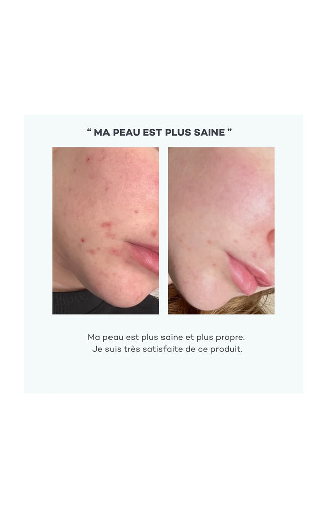 Cure peau nette & défenses naturelles - Absolu de zinc - 1 mois