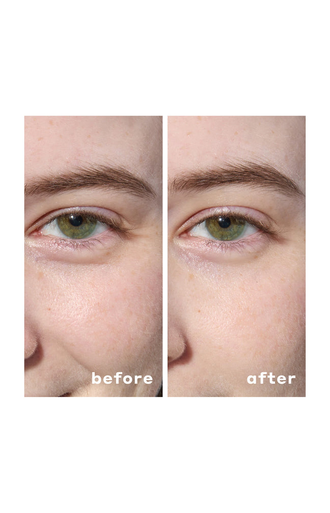 Patchs yeux hydrogel hydratants - Acide hyaluronique & niacinamide - 30 paires