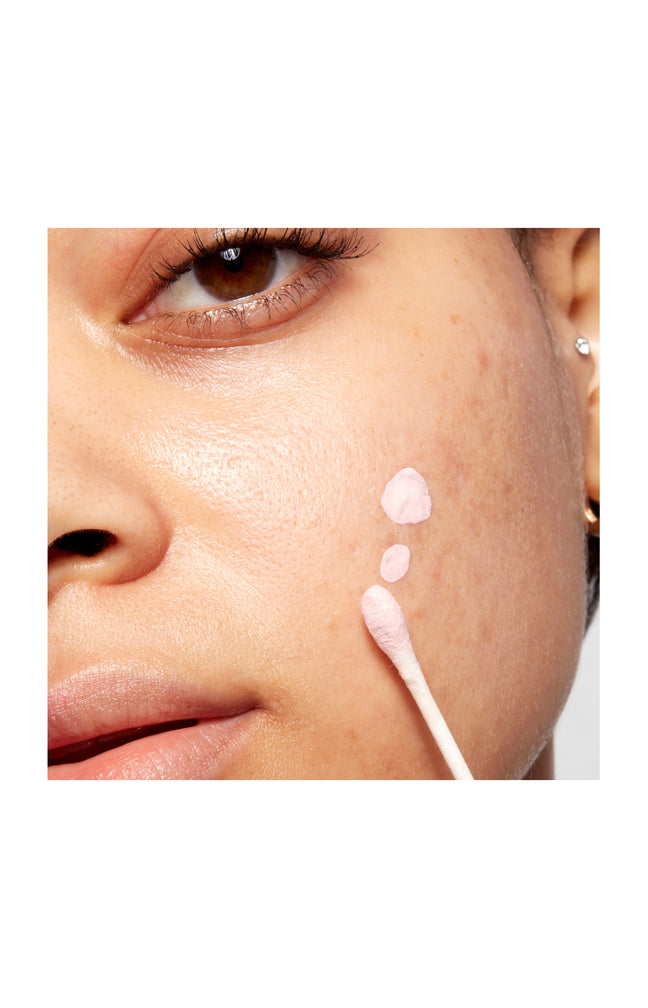 Lotion asséchante anti-boutons - Acide Salicylique & Soufre - 29 ml