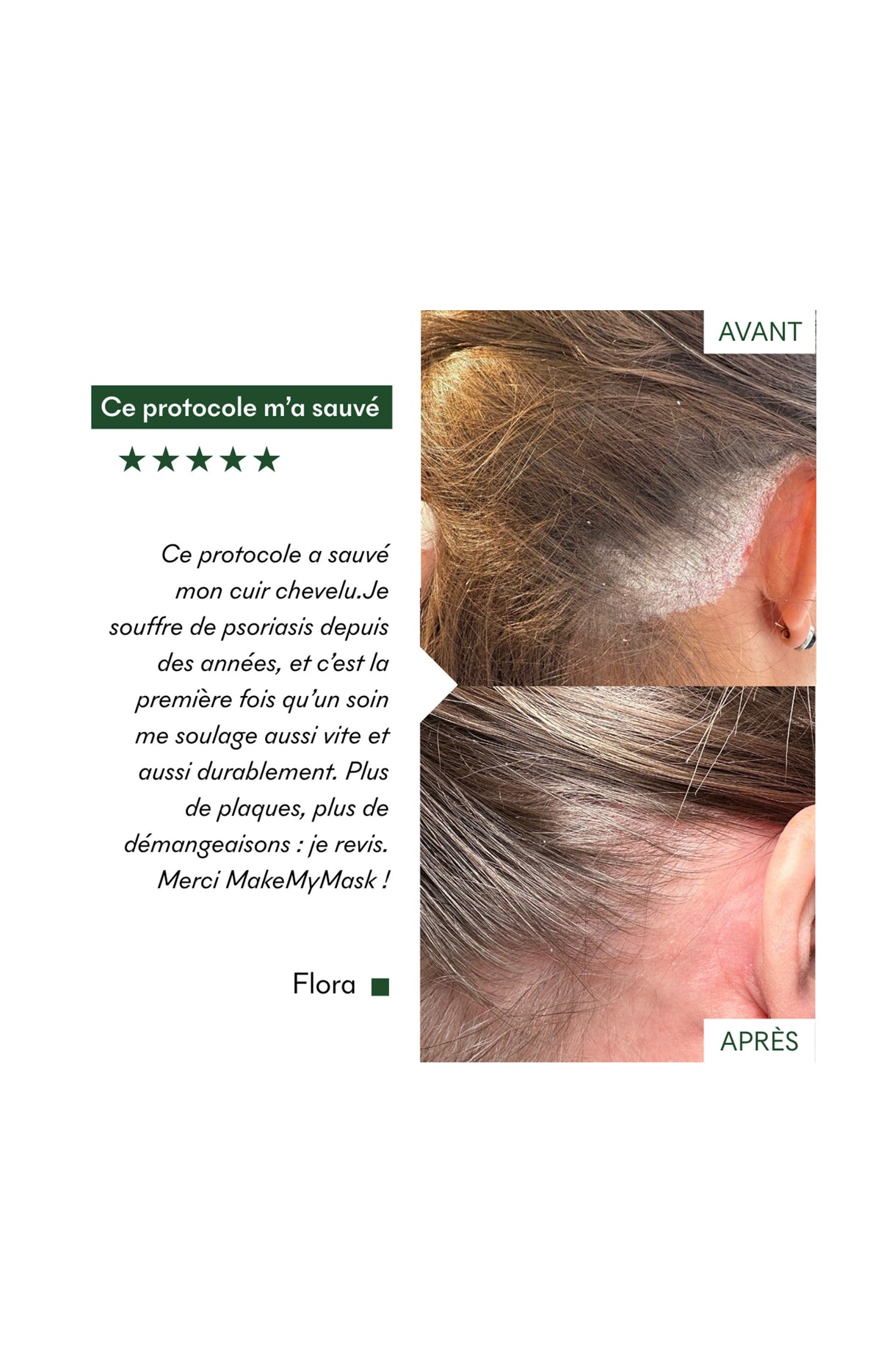 Cure flash - Complément SOS Plaques Sèches - 7 jours