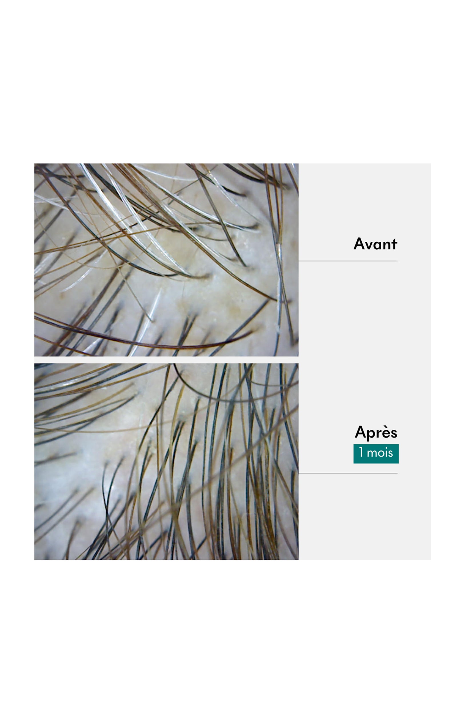 Gommage Anti-âge - 1ers Cheveux Blancs