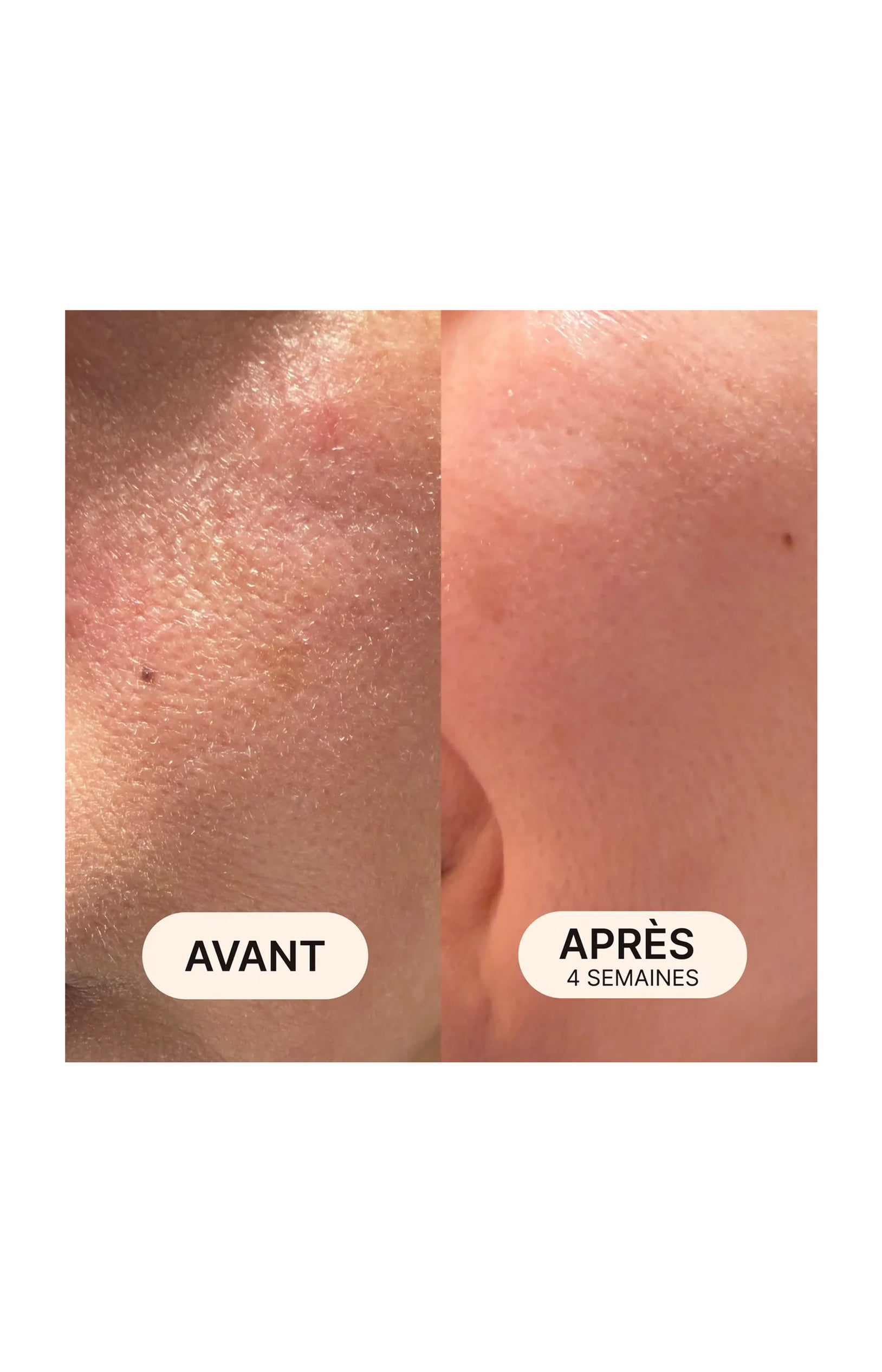 Comprimés à croquer & sérum hydratant - Acide hyaluronique & vitamine E