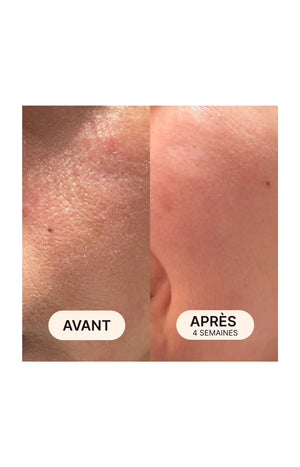 Comprimés à croquer & sérum hydratant - Acide hyaluronique & vitamine E