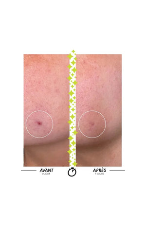 Sérum anti-imperfections & anti-âge - Elixir du Marabout - Peaux mixtes à grasses - 15 ml