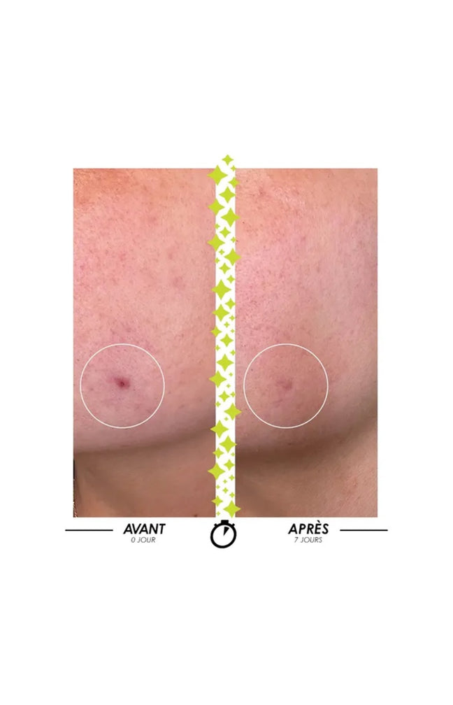 Sérum anti-imperfections & anti-âge - Elixir du Marabout - Peaux mixtes à grasses - 15 ml