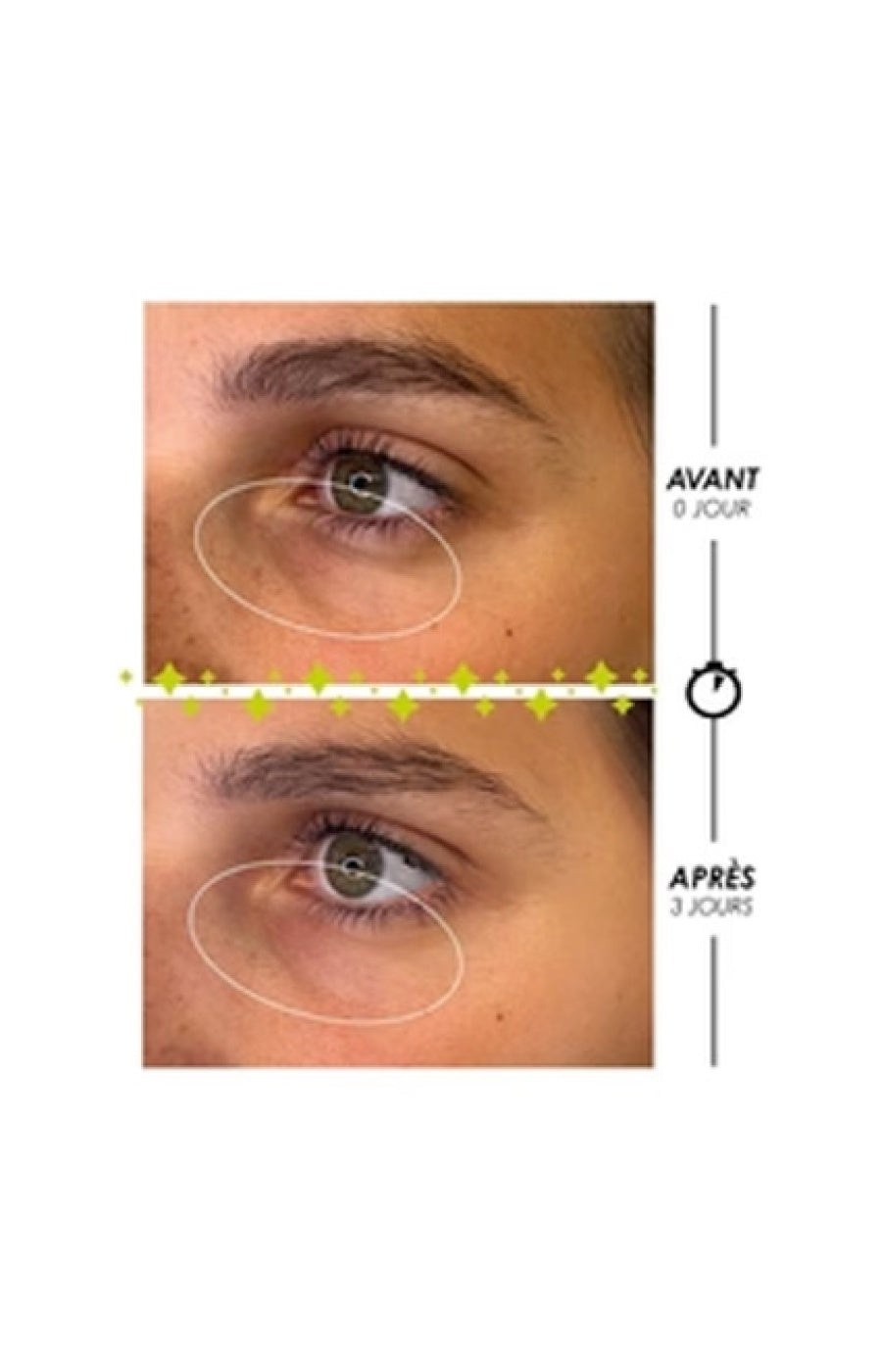 Roll-on contour des yeux anti-poches - Larmes de Fantôme - 10 ml