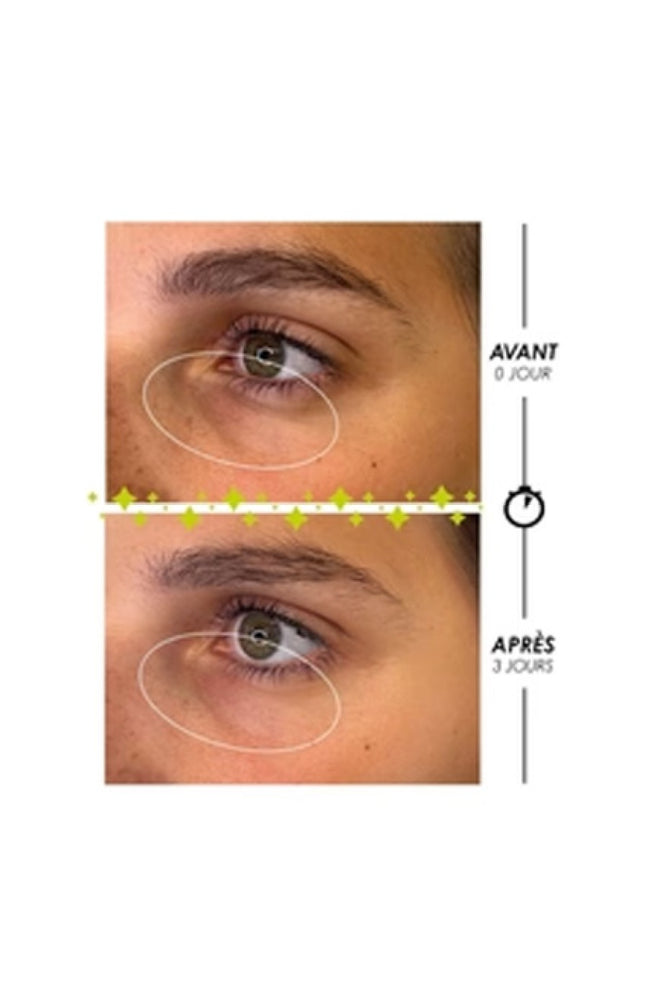 Roll-on contour des yeux anti-poches - Larmes de Fantôme - 10 ml