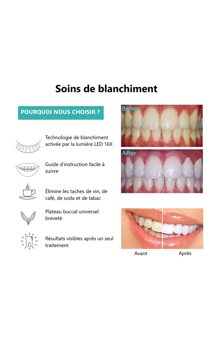 Appareil LED - Blanchiment dentaire - Blanc
