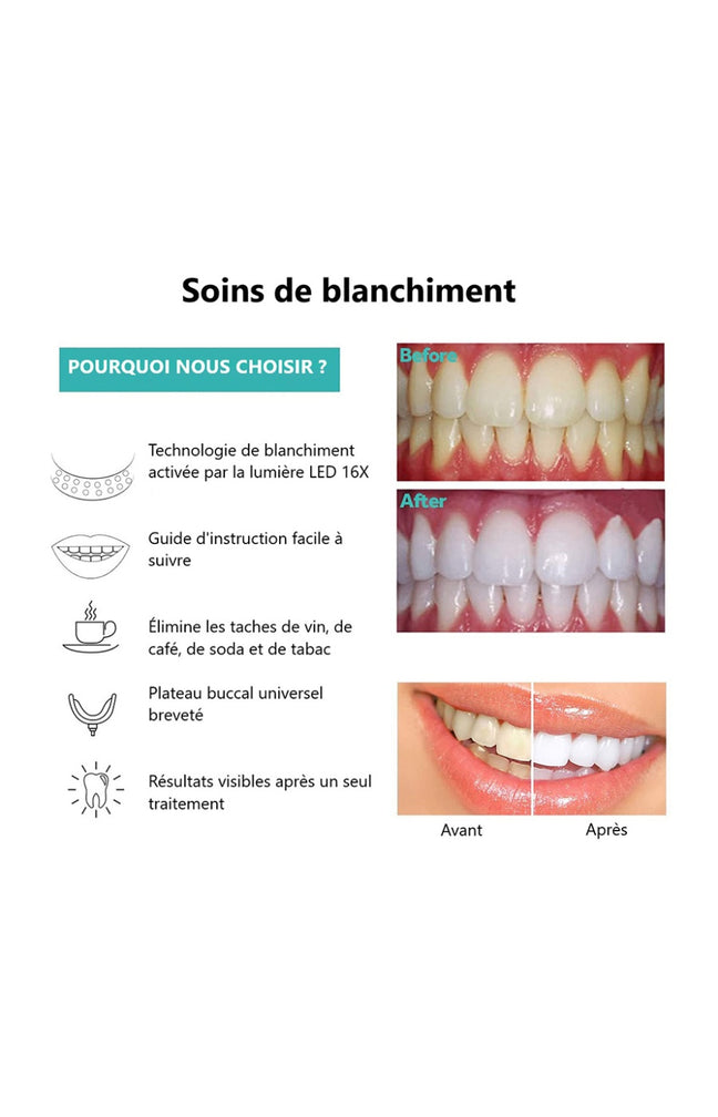 Appareil LED - Blanchiment dentaire - Blanc