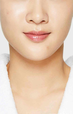 Patchs anti-imperfections - Peaux à tendance acnéique - 18 unités