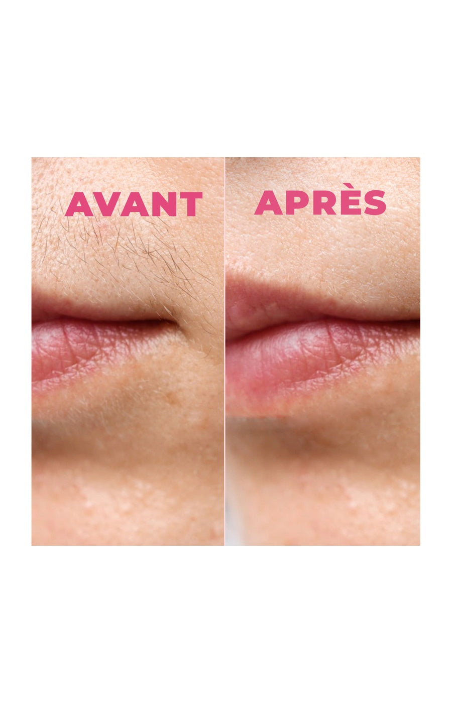 Bandes de cire froide naturelle - Fruits rouges - Visage - 20 unités