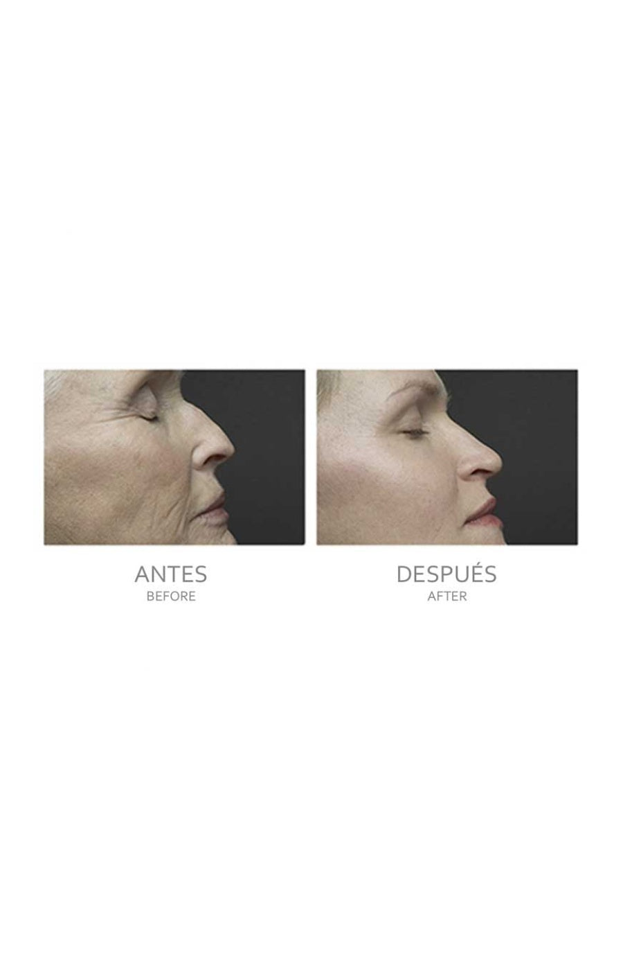 Appareil de soin de la peau 4-en-1 - Visage