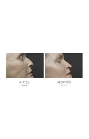 Appareil de soin de la peau 4-en-1 - Visage