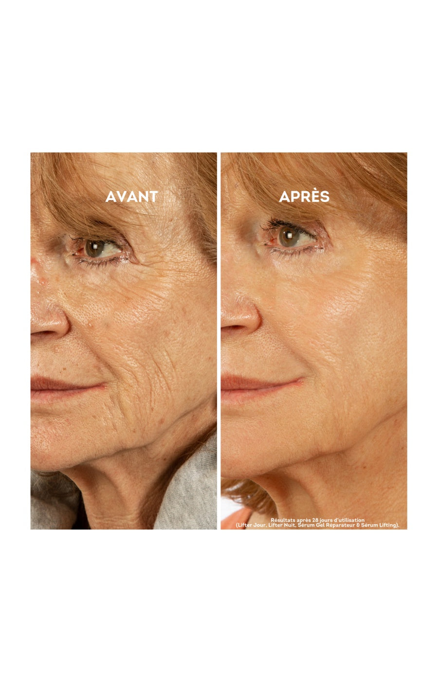 Gel réparateur anti-rides - Visage