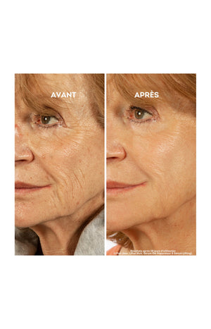 Gel réparateur anti-rides - Visage