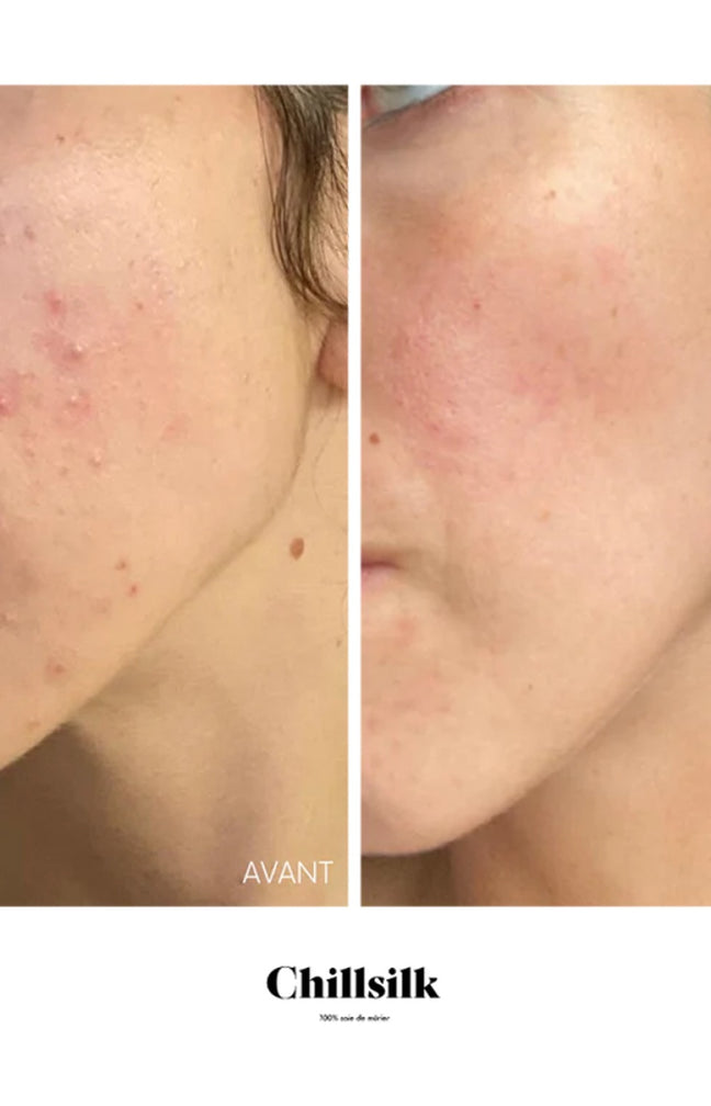 Taie d'oreiller rectangle en soie - Vichy