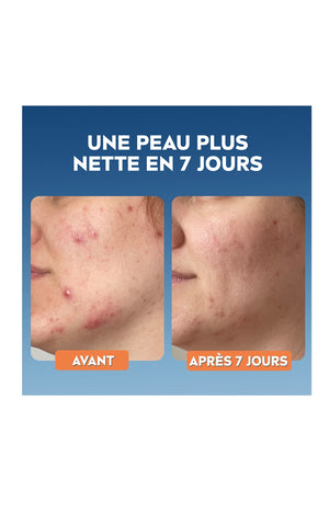 Gommage purifiant - Derma Skin Clear - Peaux à Imperfections - 150 ml
