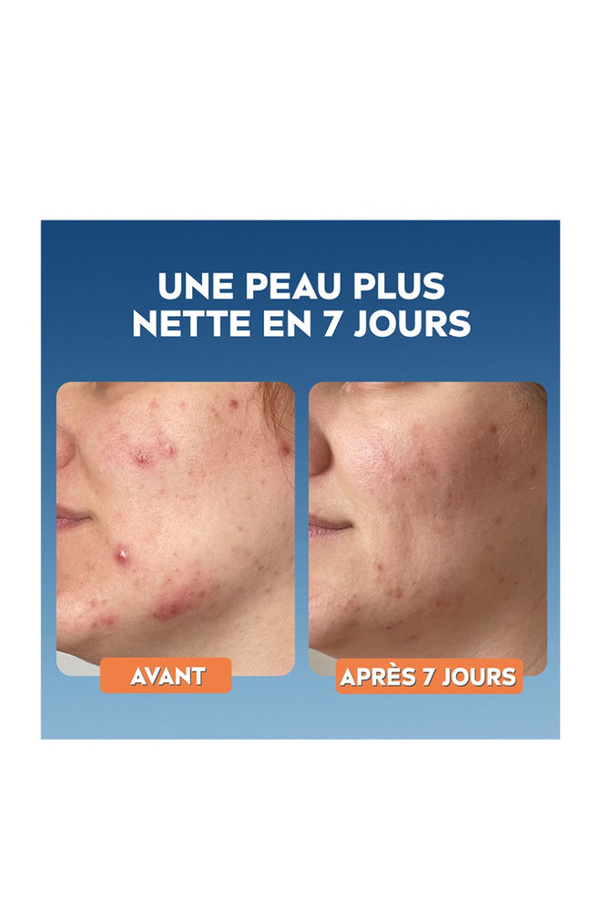 Soin exfoliant - Dema Skin Clear - Nuit - Peaux à Imperfections