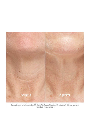 Appareil anti-âge - FaceTite Revive - Visage