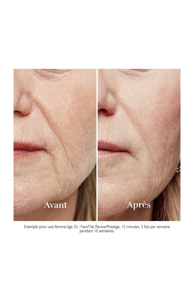 Appareil anti-âge - FaceTite Revive - Visage