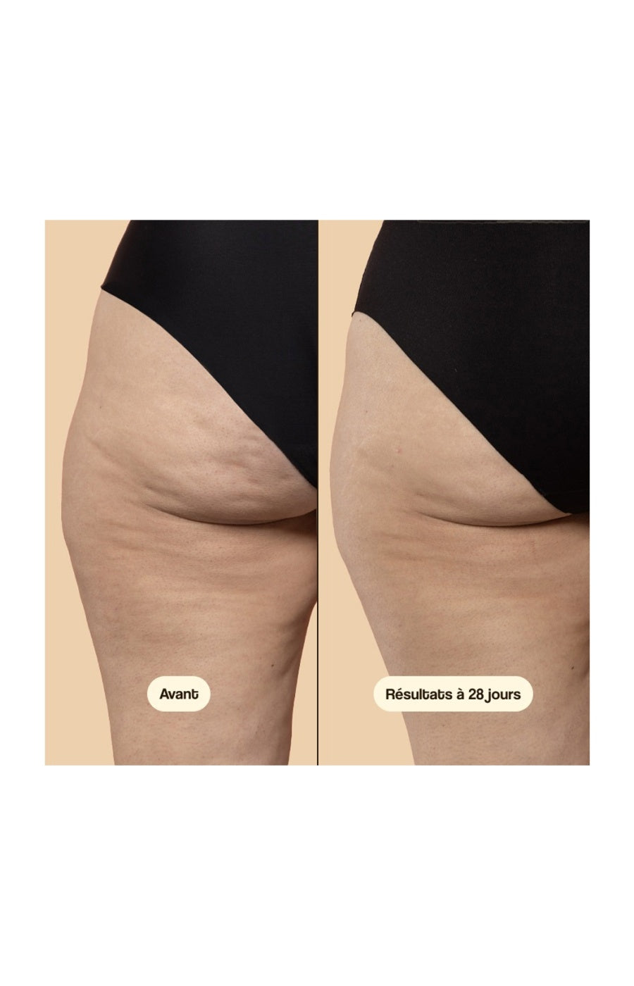 Crème anticellulite - Beta-Burner Sculpting - Corps - 200 ml