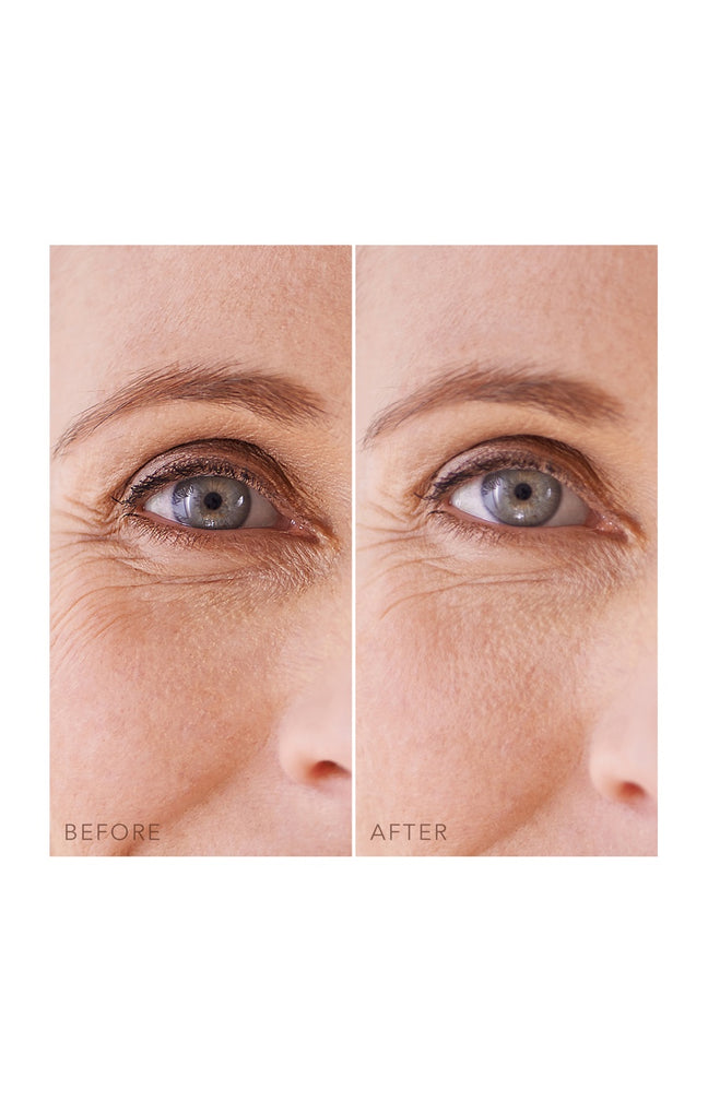 Patchs hydratants & rafraichissants - Iris Hydrogel - Yeux - 60 unités