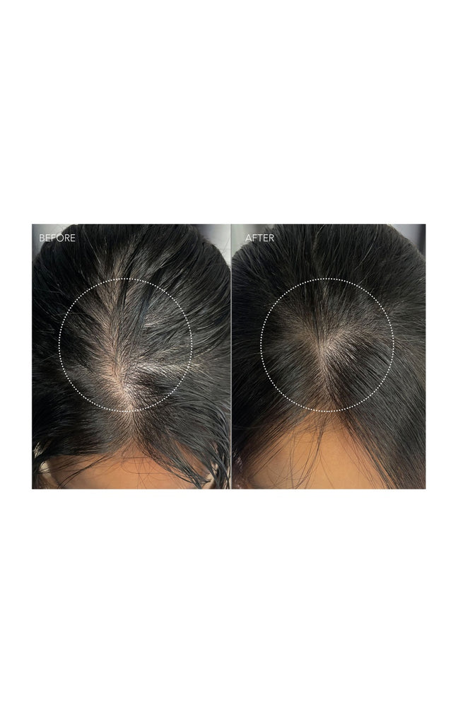 Sérum réparateur - LUNA Dual-Peptide  - Cheveux clairsemés - 60 ml