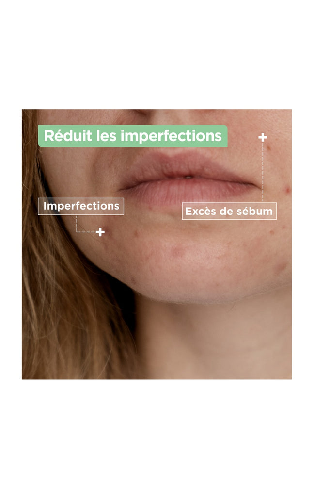 Gel nettoyant anti-imperfections - Acide salicylique & squalane - Peaux mixtes à grasses - 200 ml