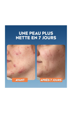 Sérum purifiant - Derma Skin Clear - Niacinamide & acide hyaluronique - Peaux à imperfections - 30 ml