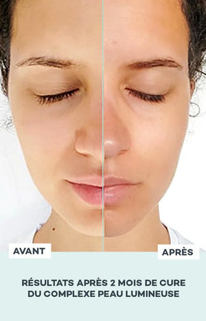 Cure éclat - Complexe Peau Lumineuse - 1 mois