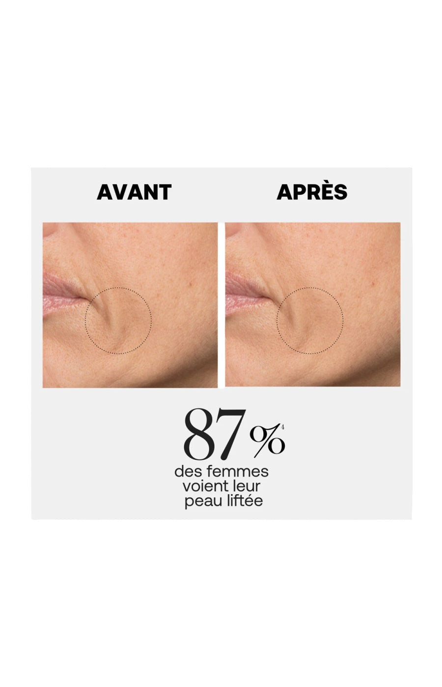 Sérum liftant anti-rides - Line killer - Visage - 30 ml