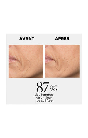 Sérum liftant anti-rides - Line killer - Visage - 30 ml
