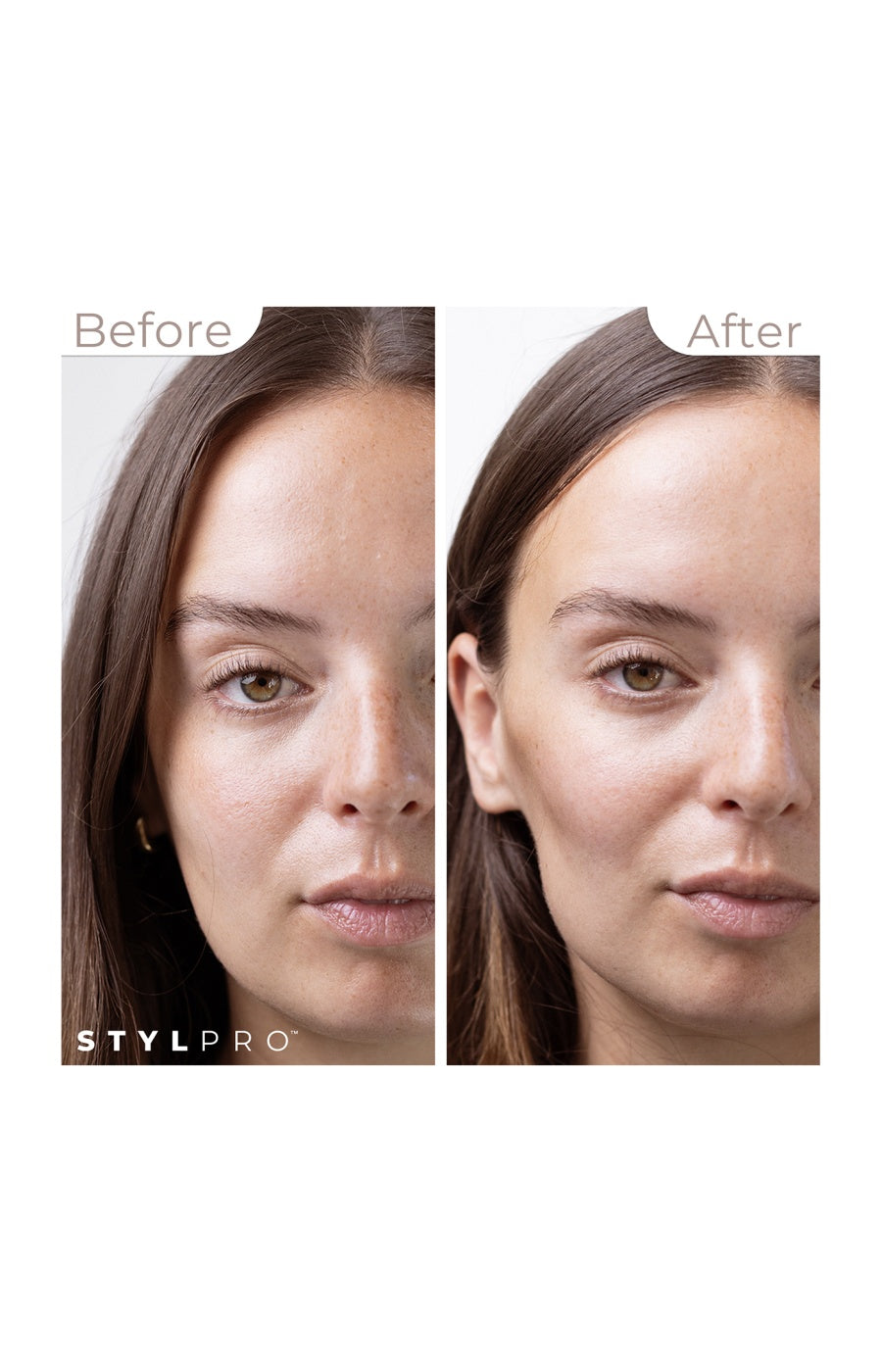 Mini appareil de tonification par microcourants - Anti-âge - Visage