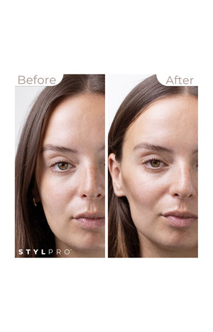 Mini appareil de tonification par microcourants - Anti-âge - Visage