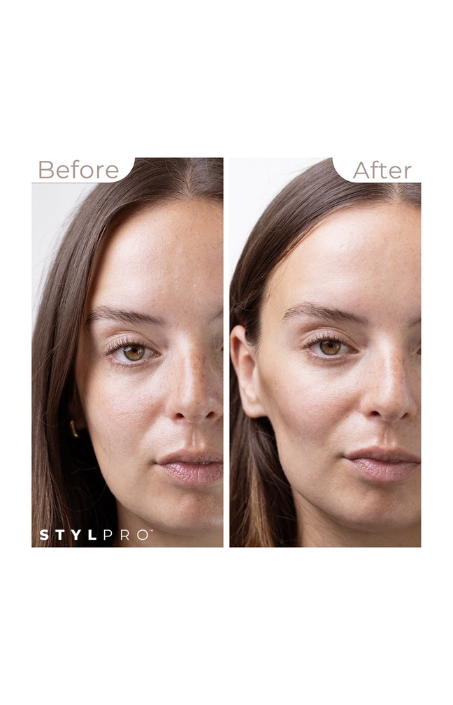 Mini appareil de tonification par microcourants - Anti-âge - Visage