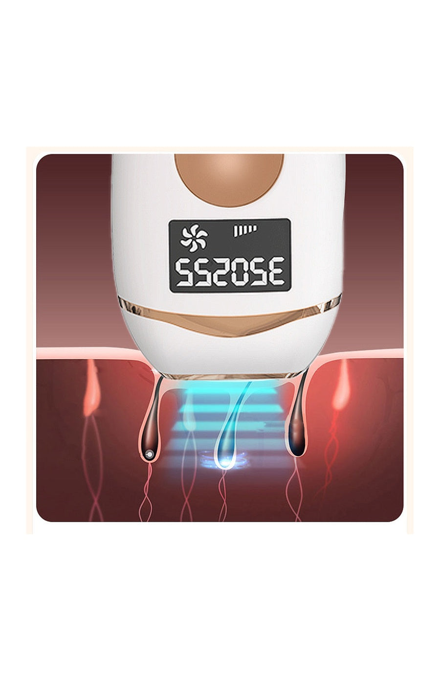 Épilateur IPL à lumière pulsée - 999 999 flashs - Corps