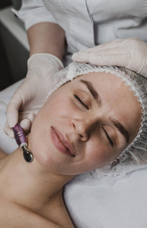 1 séance micro dermabrasion visage