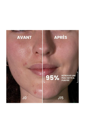 Lotion purifiante bio - Concombre - Peaux mixtes à grasses - 150 ml